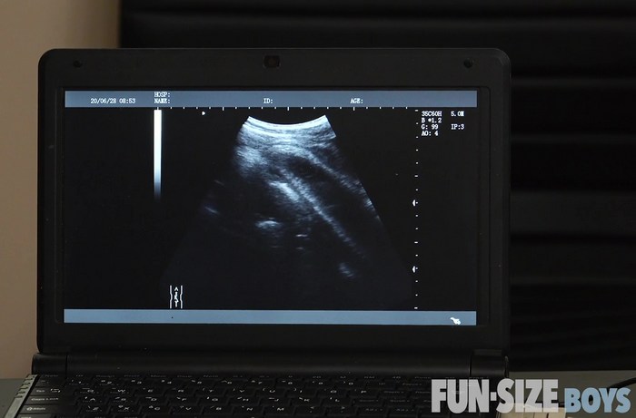 Gay Porn Doctor Ultrasound Legrand Wolf Austin Young